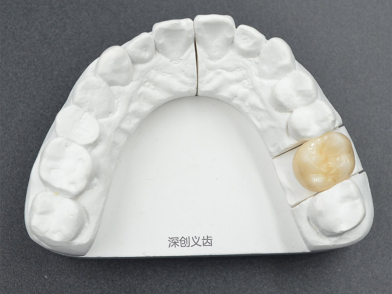 全瓷美容修復(fù)