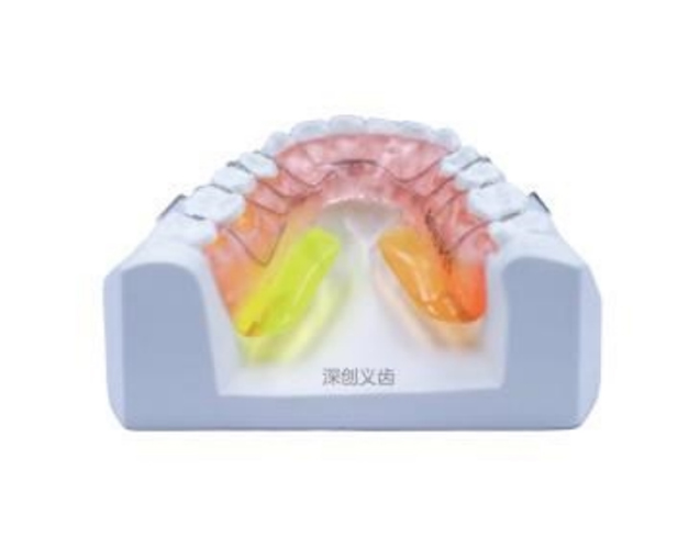 抬舌器
