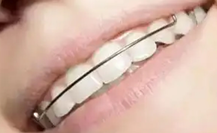 正畸案例