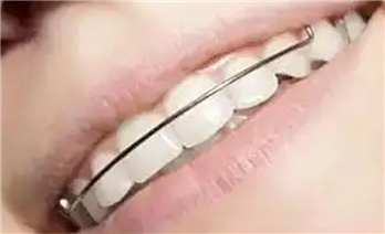 精美案例